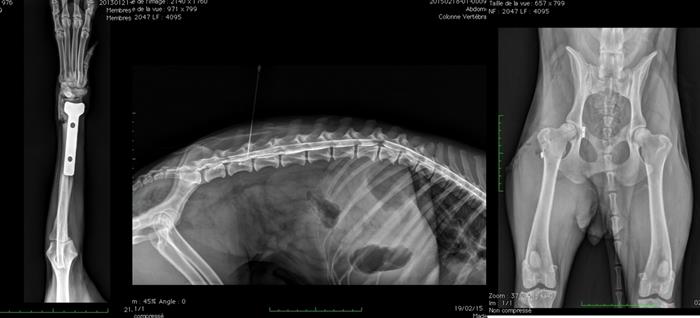 Radiographies suite à des chirurgies orthopédiques